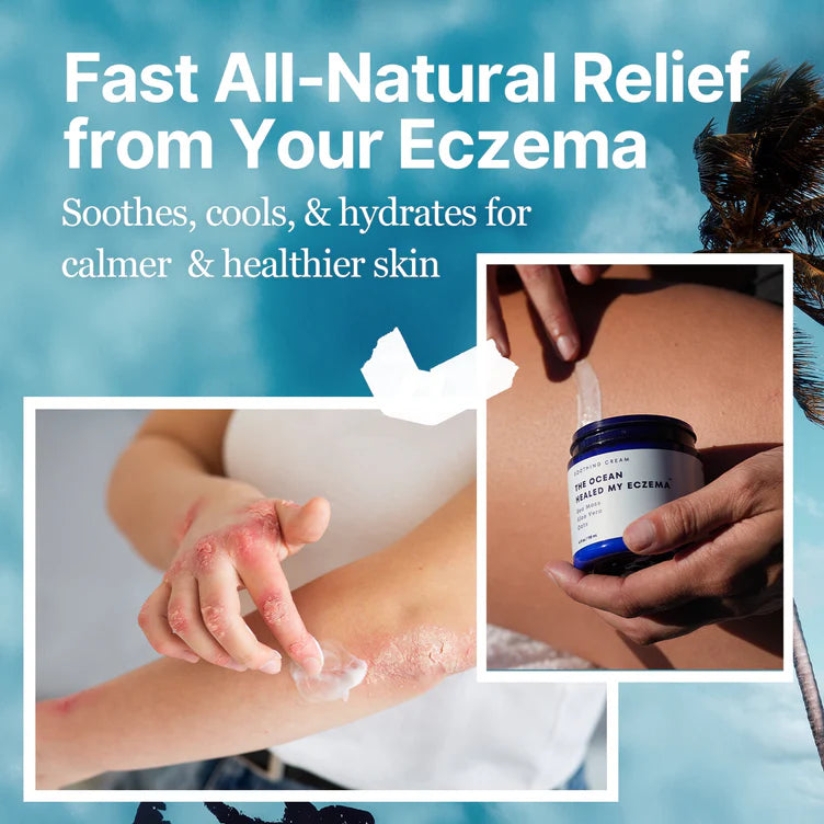 The Ocean Healed My Eczema Natural & Soothing Eczema Cream