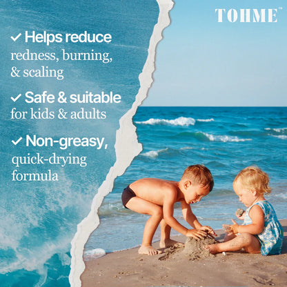The Ocean Healed My Eczema Natural & Soothing Eczema Cream