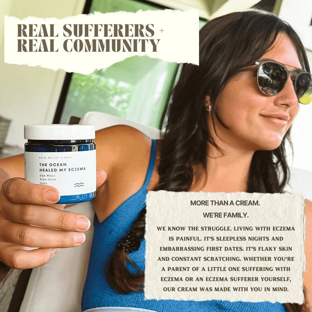 The Ocean Healed My Eczema Natural & Soothing Eczema Cream
